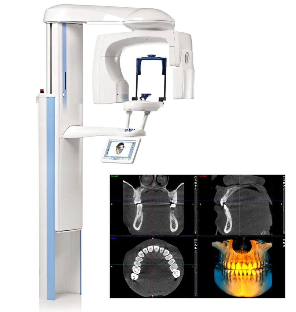 Equipos de Radiología Digital RAO