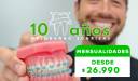mensualidades_de_brackets_desde_26990_clinicas_rao